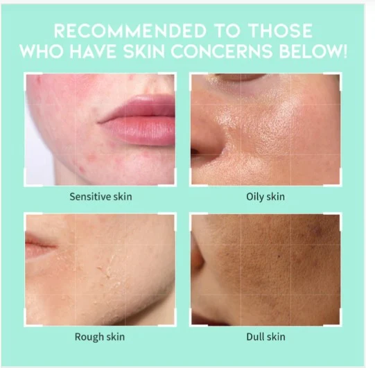 OOTD Heartleaf Pore Zero Cleanser